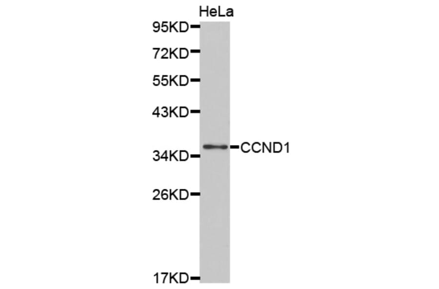 Western blot - CCND1 Antibody from Signalway Antibody (32262) - Antibodies.com