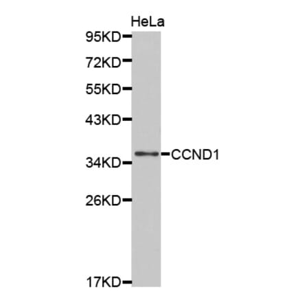 Western blot - CCND1 Antibody from Signalway Antibody (32262) - Antibodies.com