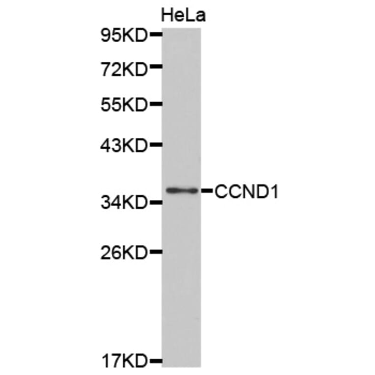 Western blot - CCND1 Antibody from Signalway Antibody (32262) - Antibodies.com