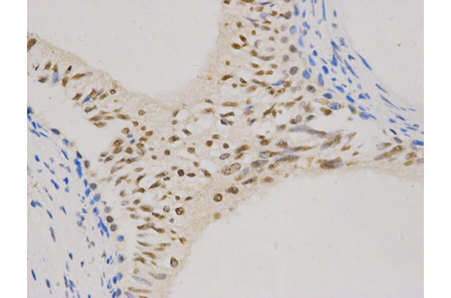 Immunohistochemistry - CCND1 Antibody from Signalway Antibody (32262) - Antibodies.com