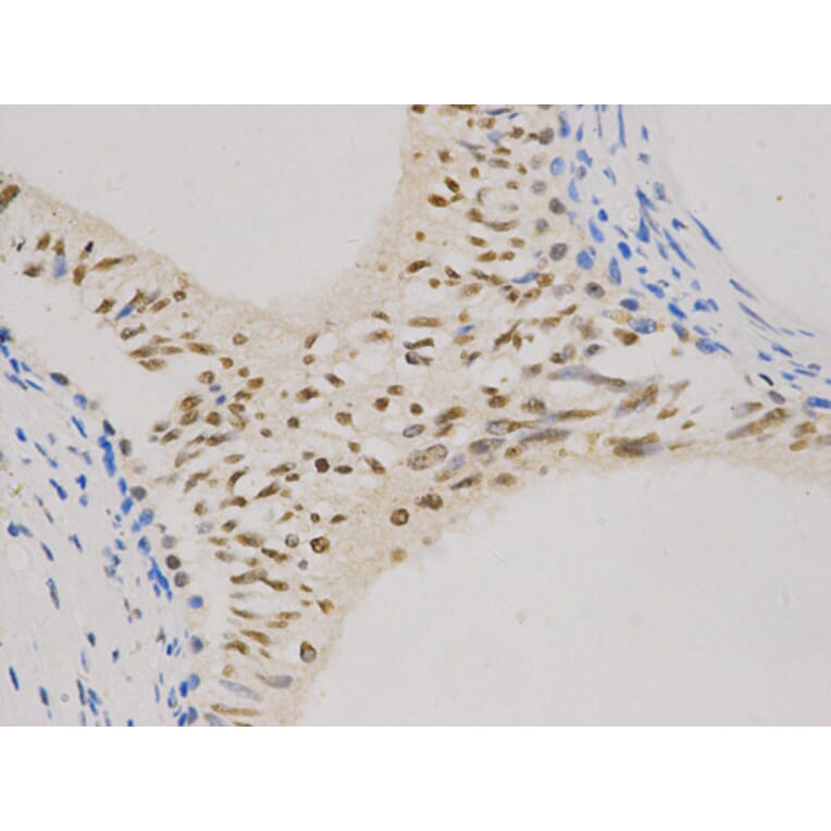 Immunohistochemistry - CCND1 Antibody from Signalway Antibody (32262) - Antibodies.com