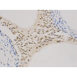 Immunohistochemistry - CCND1 Antibody from Signalway Antibody (32262) - Antibodies.com