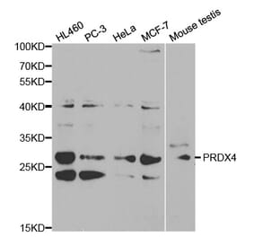 Western blot - PRDX4 Antibody from Signalway Antibody (32288) - Antibodies.com