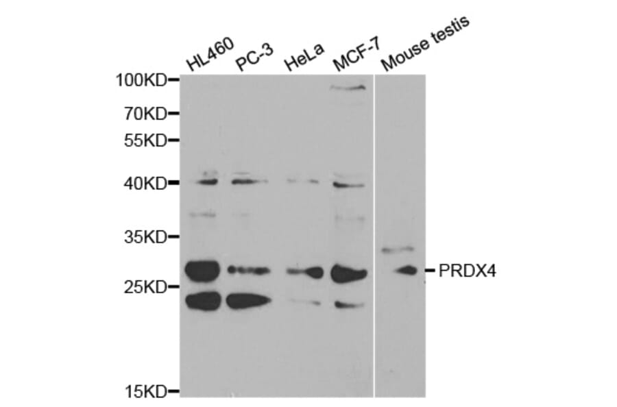 Western blot - PRDX4 Antibody from Signalway Antibody (32288) - Antibodies.com