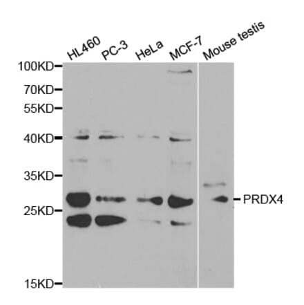 Western blot - PRDX4 Antibody from Signalway Antibody (32288) - Antibodies.com