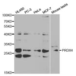 Western blot - PRDX4 Antibody from Signalway Antibody (32288) - Antibodies.com