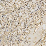 Immunohistochemistry - PRDX4 Antibody from Signalway Antibody (32288) - Antibodies.com