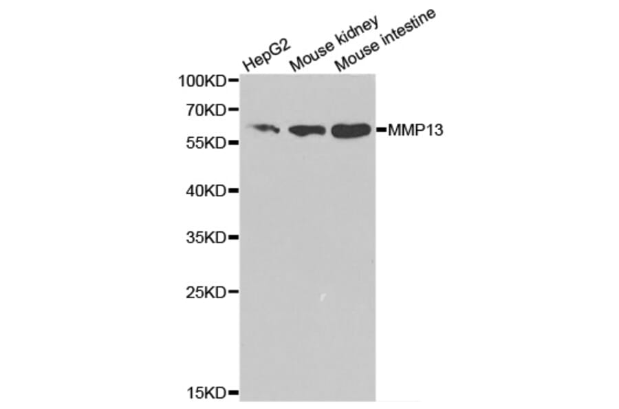Western blot - MMP13 Antibody from Signalway Antibody (32335) - Antibodies.com