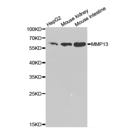 Western blot - MMP13 Antibody from Signalway Antibody (32335) - Antibodies.com