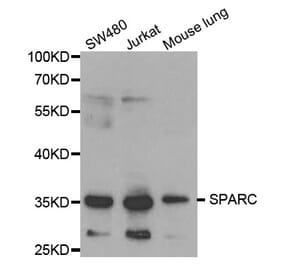 Western blot - SPARC Antibody from Signalway Antibody (32342) - Antibodies.com