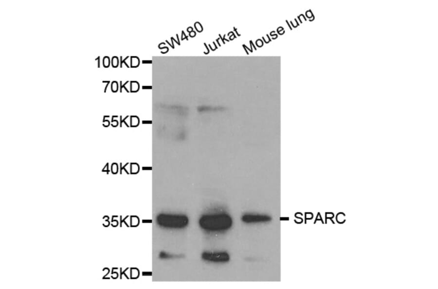 Western blot - SPARC Antibody from Signalway Antibody (32342) - Antibodies.com