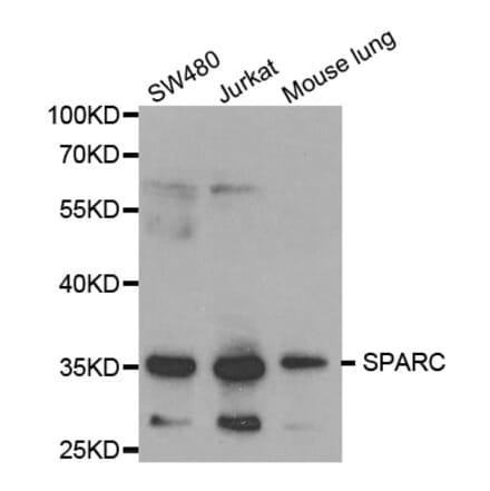 Western blot - SPARC Antibody from Signalway Antibody (32342) - Antibodies.com