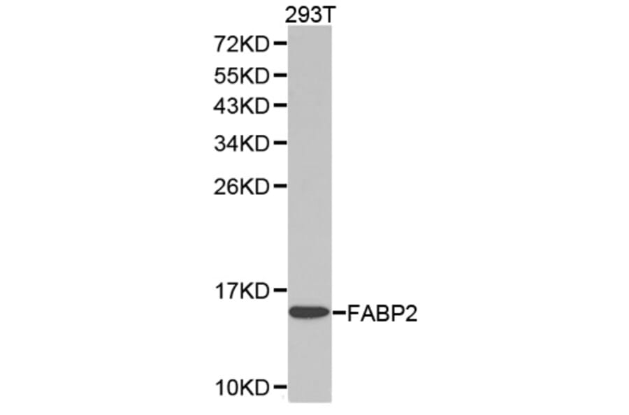 Western blot - FABP2 Antibody from Signalway Antibody (32347) - Antibodies.com