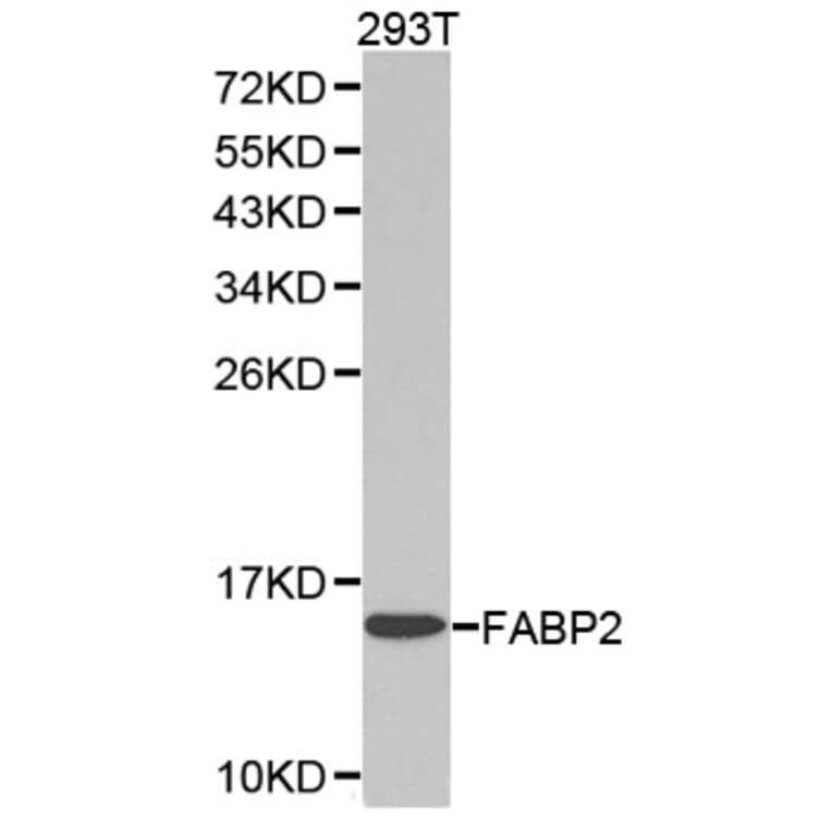 Western blot - FABP2 Antibody from Signalway Antibody (32347) - Antibodies.com