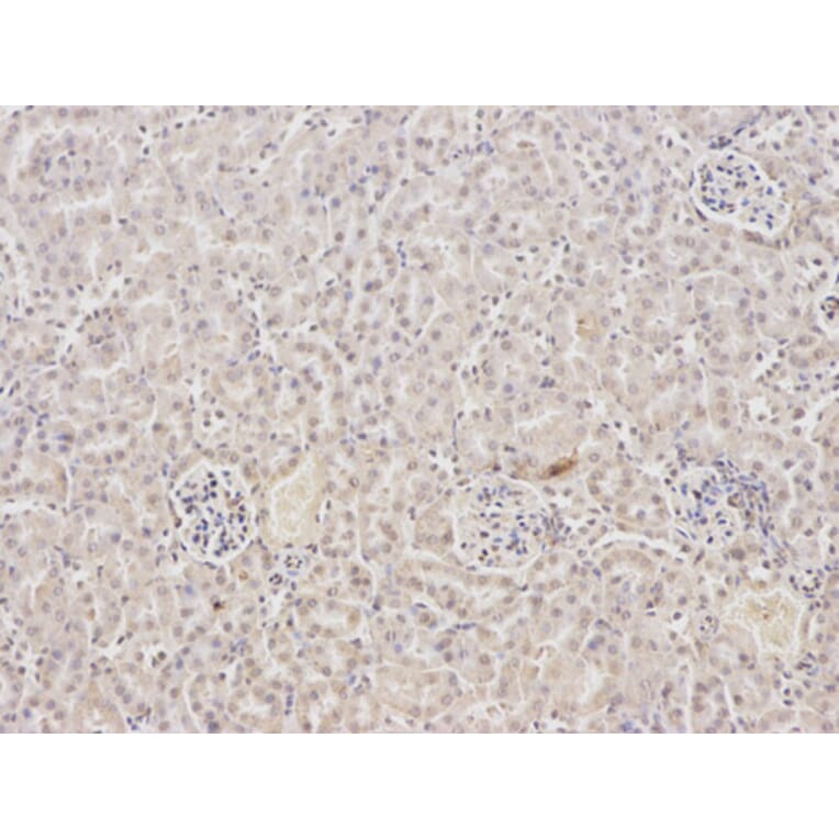 Immunohistochemistry - FABP2 Antibody from Signalway Antibody (32347) - Antibodies.com