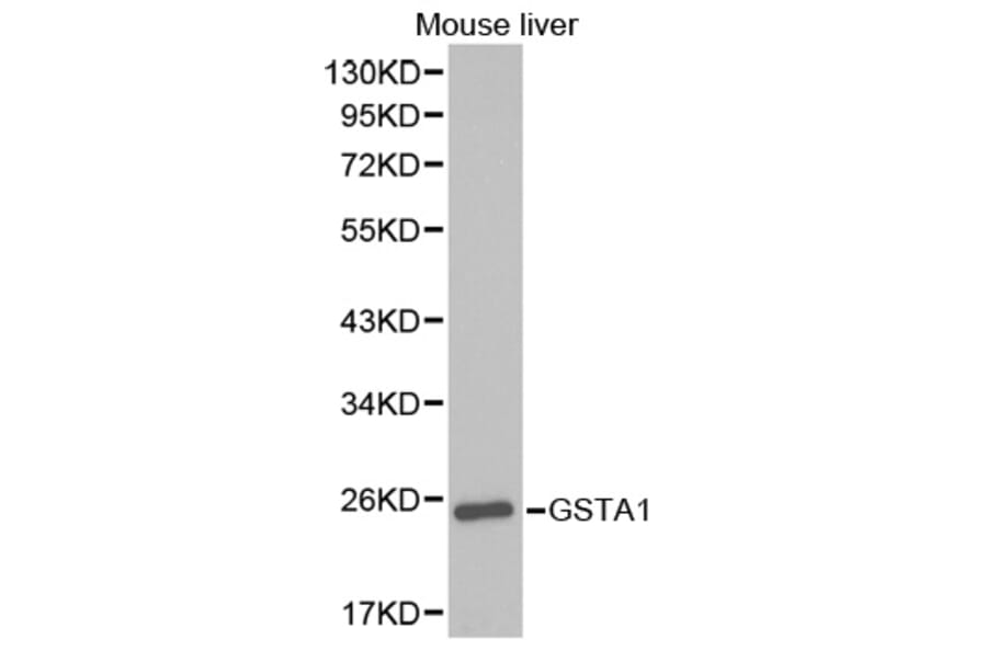 Western blot - GSTA1 Antibody from Signalway Antibody (32353) - Antibodies.com