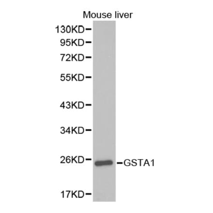 Western blot - GSTA1 Antibody from Signalway Antibody (32353) - Antibodies.com
