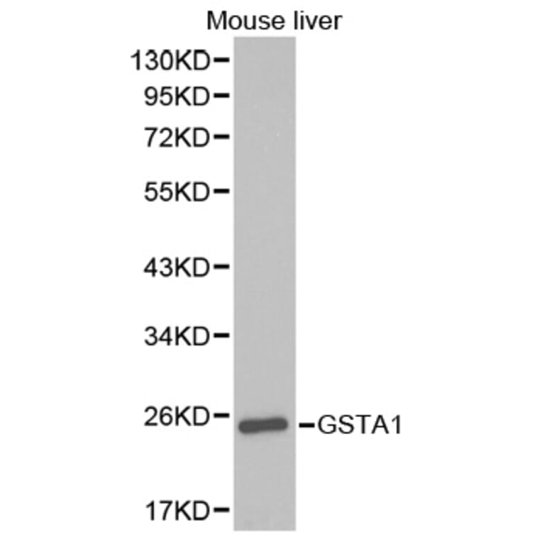 Western blot - GSTA1 Antibody from Signalway Antibody (32353) - Antibodies.com