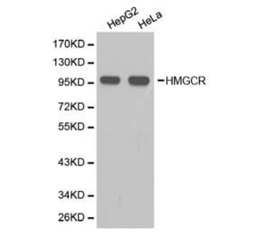 Western blot - HMGCR Antibody from Signalway Antibody (32356) - Antibodies.com