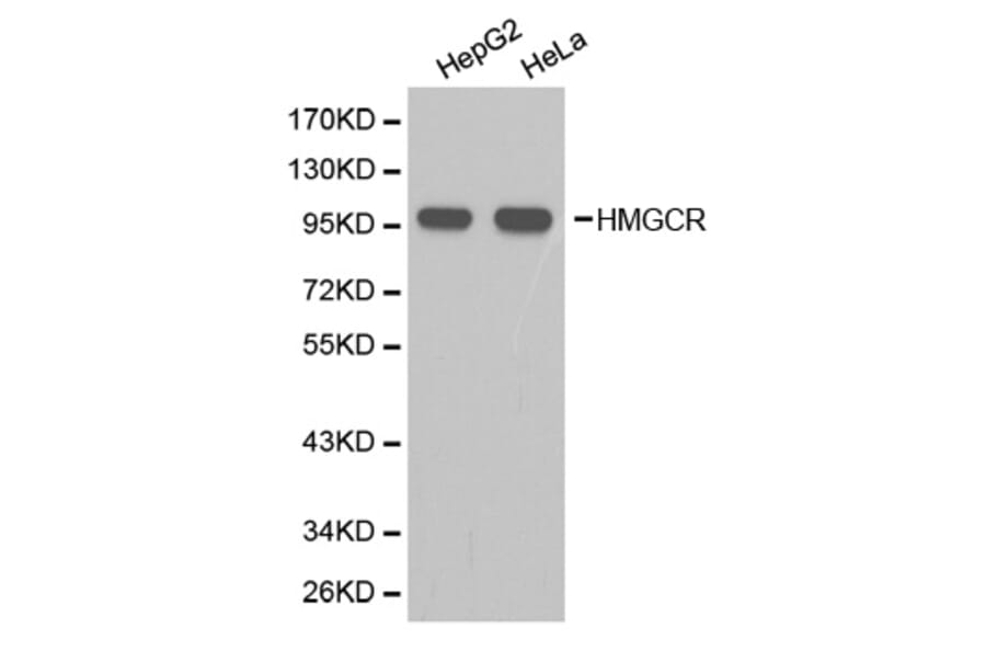 Western blot - HMGCR Antibody from Signalway Antibody (32356) - Antibodies.com
