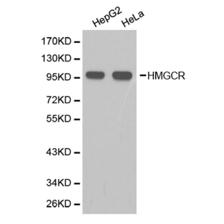 Western blot - HMGCR Antibody from Signalway Antibody (32356) - Antibodies.com