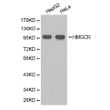 Western blot - HMGCR Antibody from Signalway Antibody (32356) - Antibodies.com