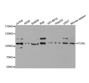 Western blot - ITGAL Antibody from Signalway Antibody (32362) - Antibodies.com