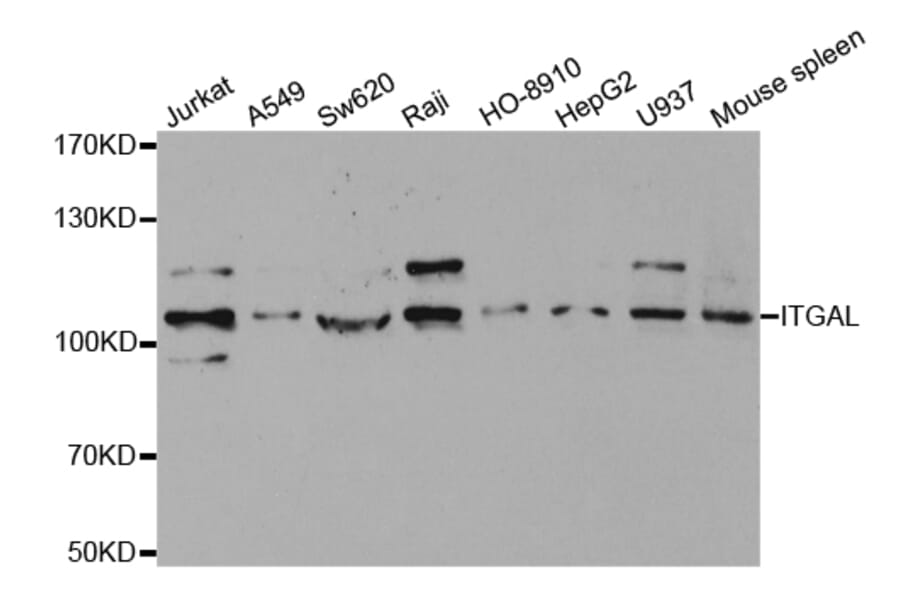 Western blot - ITGAL Antibody from Signalway Antibody (32362) - Antibodies.com