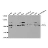 Western blot - ITGAL Antibody from Signalway Antibody (32362) - Antibodies.com