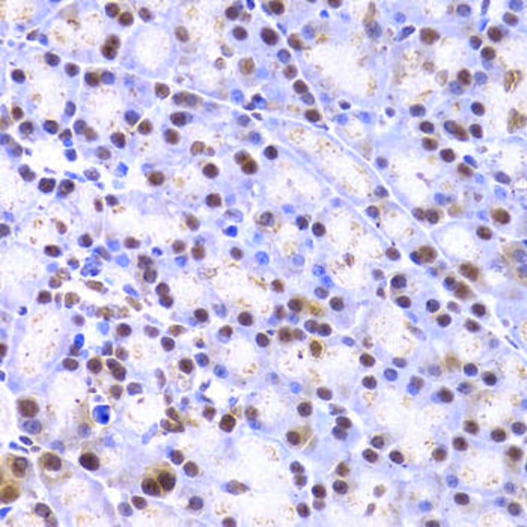 Immunohistochemistry - XRCC4 Antibody from Signalway Antibody (32382) - Antibodies.com