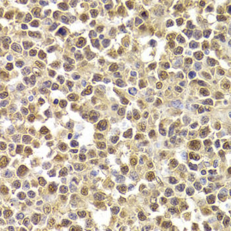 Immunohistochemistry - XRCC4 Antibody from Signalway Antibody (32382) - Antibodies.com