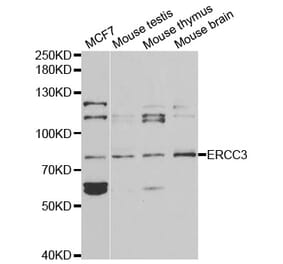 Western blot - ERCC3 Antibody from Signalway Antibody (32399) - Antibodies.com