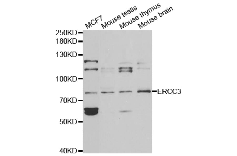 Western blot - ERCC3 Antibody from Signalway Antibody (32399) - Antibodies.com