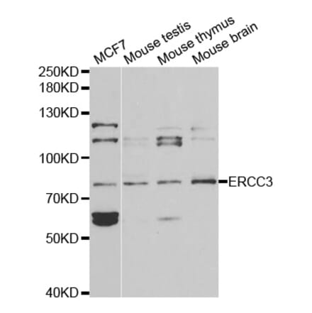 Western blot - ERCC3 Antibody from Signalway Antibody (32399) - Antibodies.com