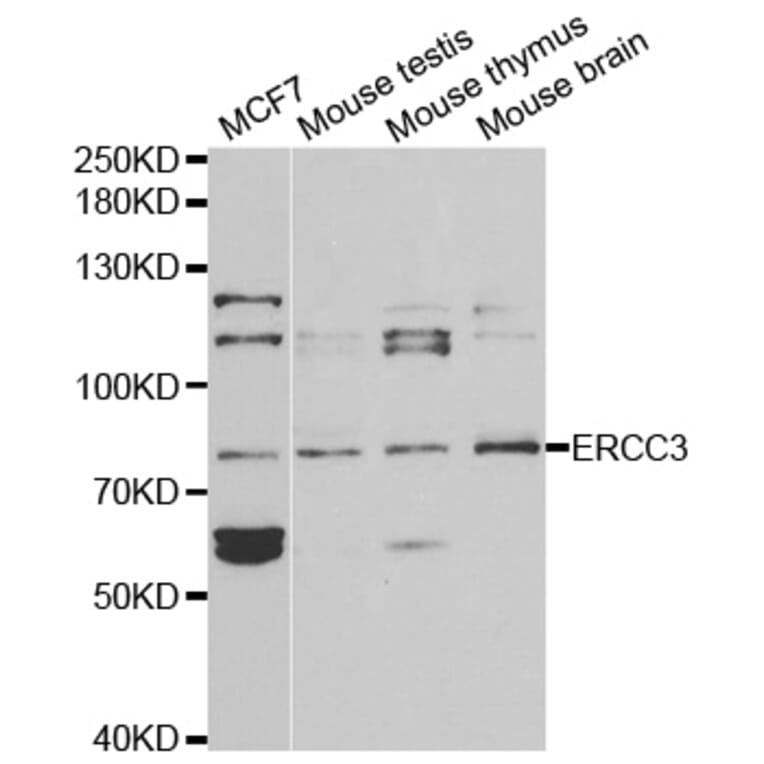 Western blot - ERCC3 Antibody from Signalway Antibody (32399) - Antibodies.com