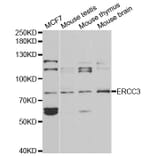 Western blot - ERCC3 Antibody from Signalway Antibody (32399) - Antibodies.com