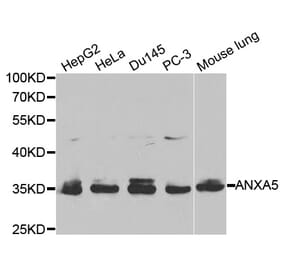 Western blot - ANXA5 Antibody from Signalway Antibody (32405) - Antibodies.com