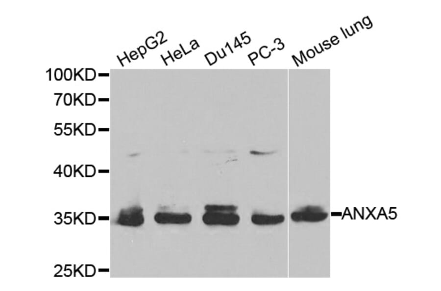 Western blot - ANXA5 Antibody from Signalway Antibody (32405) - Antibodies.com