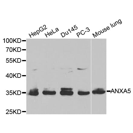 Western blot - ANXA5 Antibody from Signalway Antibody (32405) - Antibodies.com