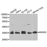 Western blot - ANXA5 Antibody from Signalway Antibody (32405) - Antibodies.com