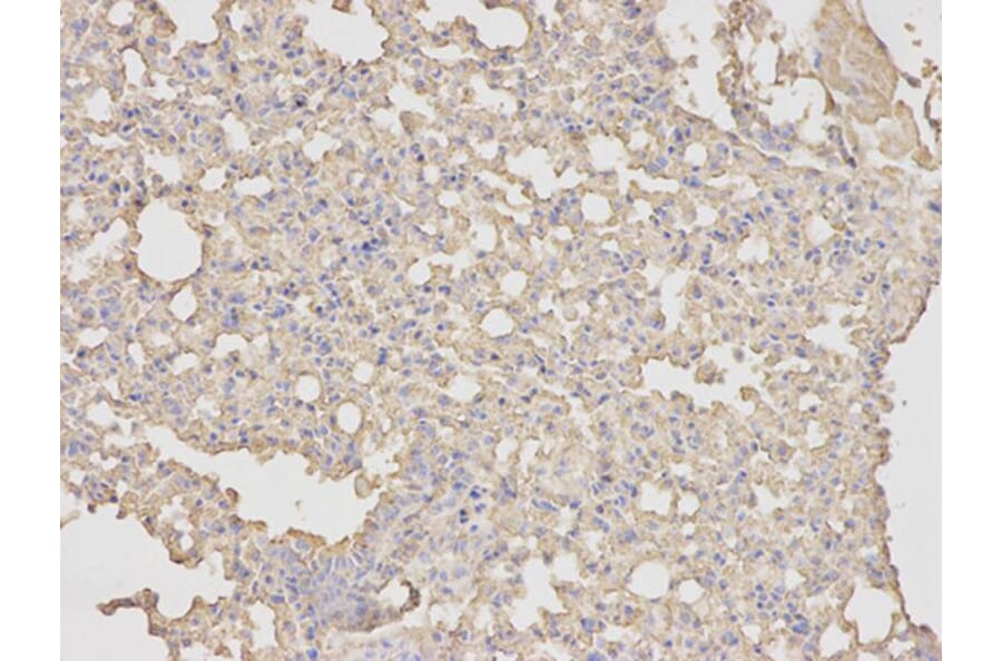 Immunohistochemistry - ANXA5 Antibody from Signalway Antibody (32405) - Antibodies.com