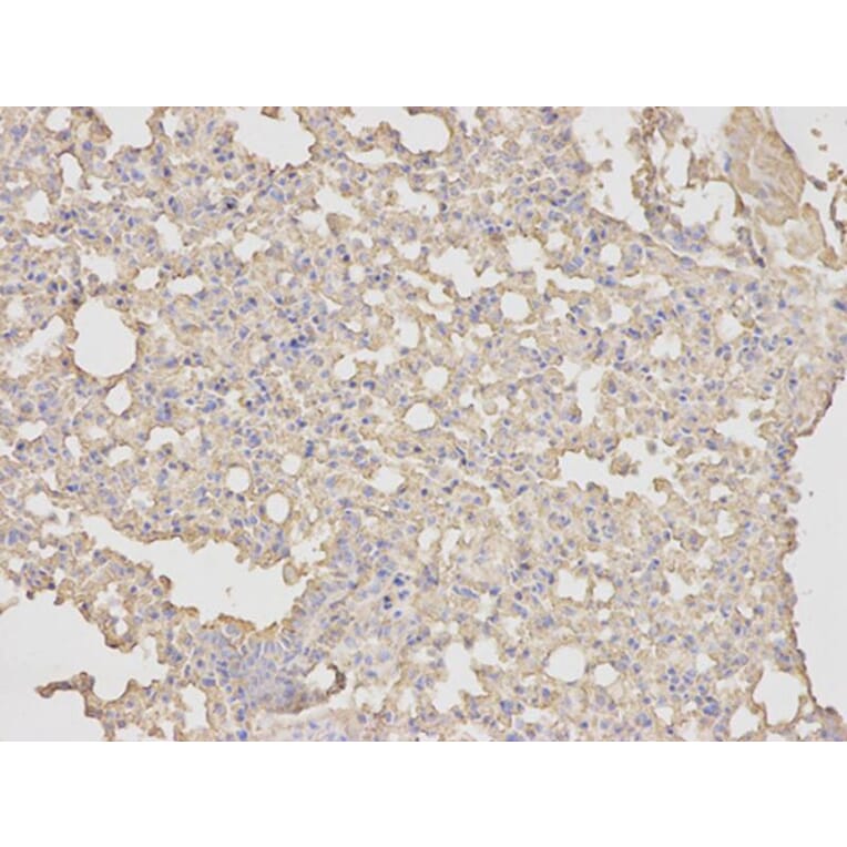 Immunohistochemistry - ANXA5 Antibody from Signalway Antibody (32405) - Antibodies.com