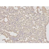 Immunohistochemistry - ANXA5 Antibody from Signalway Antibody (32405) - Antibodies.com