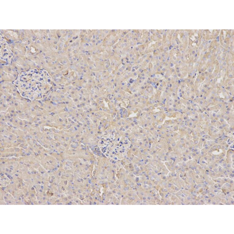 Immunohistochemistry - ANXA5 Antibody from Signalway Antibody (32405) - Antibodies.com