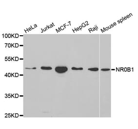 Western blot - NR0B1 Antibody from Signalway Antibody (32408) - Antibodies.com