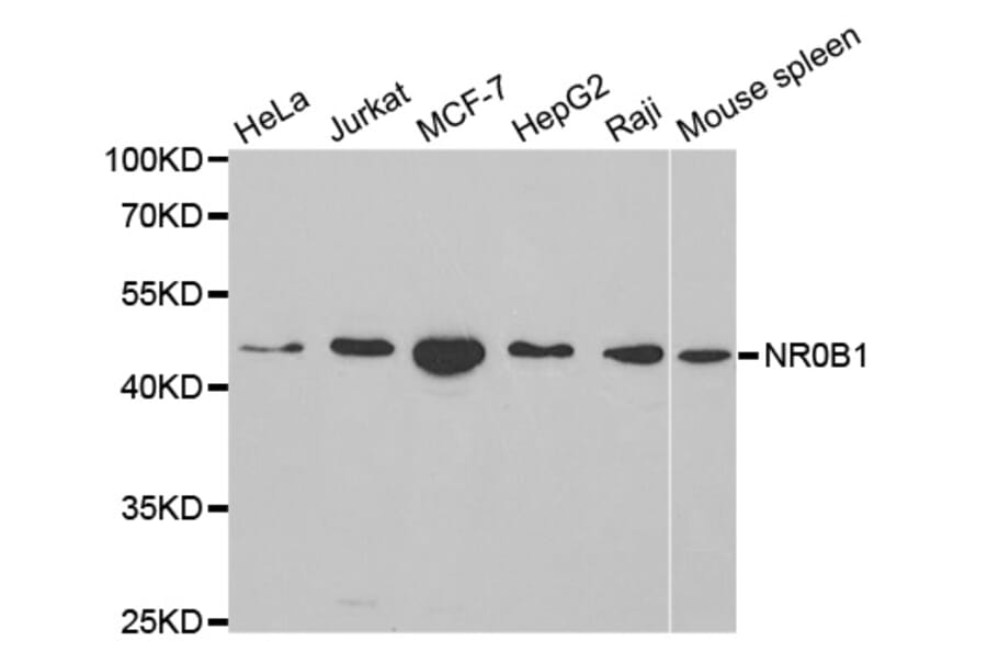 Western blot - NR0B1 Antibody from Signalway Antibody (32408) - Antibodies.com