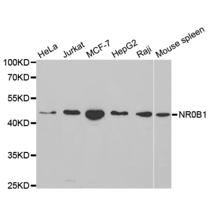 Western blot - NR0B1 Antibody from Signalway Antibody (32408) - Antibodies.com