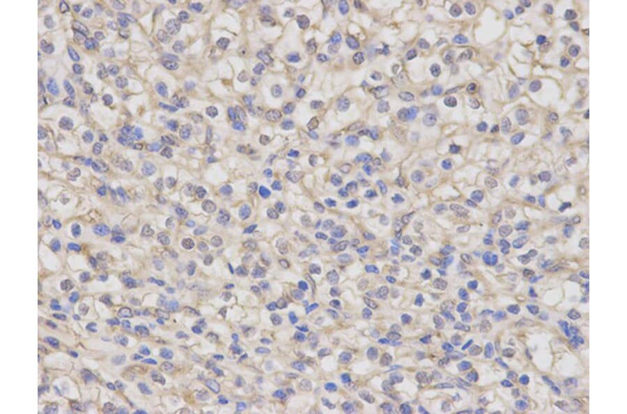 Immunohistochemistry - NR0B1 Antibody from Signalway Antibody (32408) - Antibodies.com