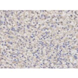 Immunohistochemistry - NR0B1 Antibody from Signalway Antibody (32408) - Antibodies.com