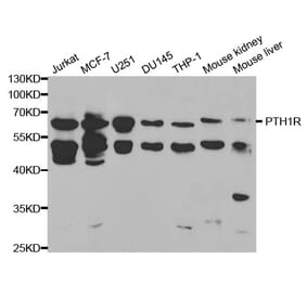 Western blot - PTH1R Antibody from Signalway Antibody (32412) - Antibodies.com